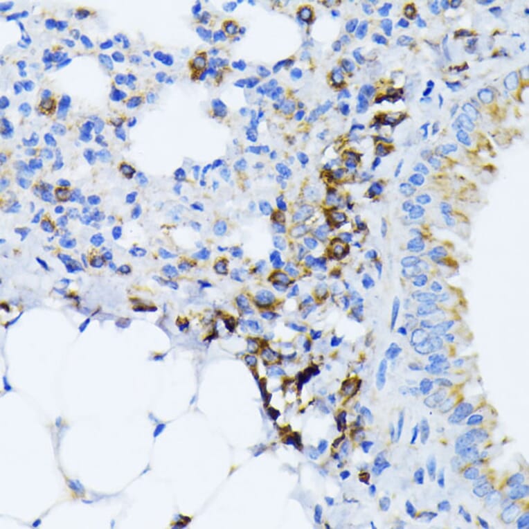 Immunohistochemistry - Anti-GRP78 BiP Antibody (A12567) - Antibodies.com