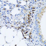 Immunohistochemistry - Anti-GRP78 BiP Antibody (A12567) - Antibodies.com