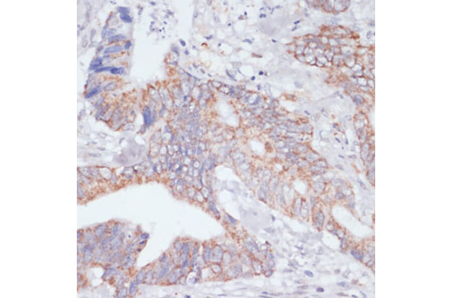 Immunohistochemistry - Anti-IKKi/IKKe Antibody (A12568) - Antibodies.com