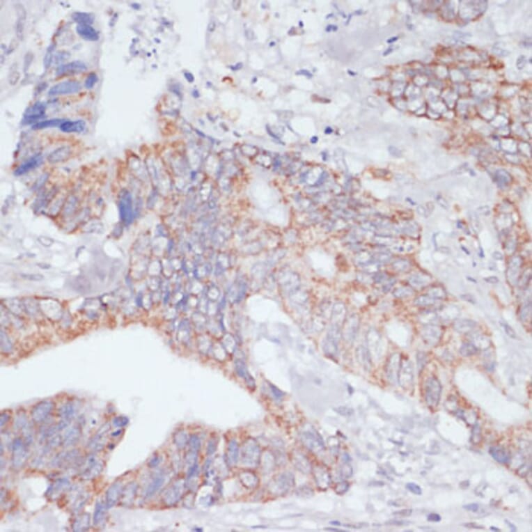 Immunohistochemistry - Anti-IKKi/IKKe Antibody (A12568) - Antibodies.com