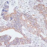 Immunohistochemistry - Anti-IKKi/IKKe Antibody (A12568) - Antibodies.com