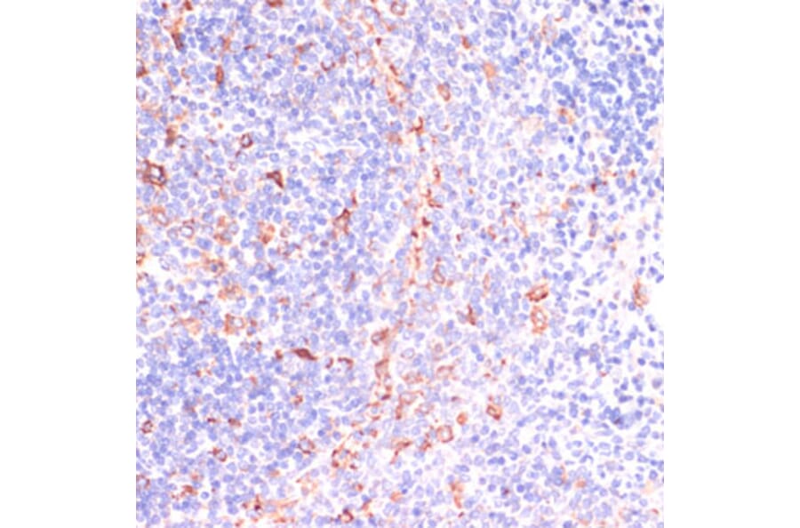 Immunohistochemistry - Anti-IKKi/IKKe Antibody (A12568) - Antibodies.com