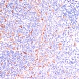 Immunohistochemistry - Anti-IKKi/IKKe Antibody (A12568) - Antibodies.com