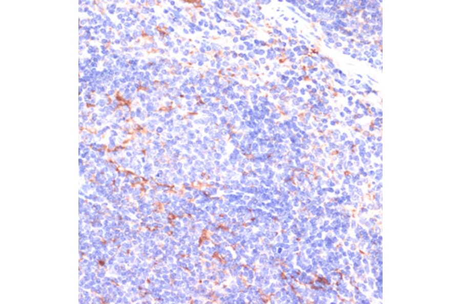 Immunohistochemistry - Anti-IKKi/IKKe Antibody (A12568) - Antibodies.com