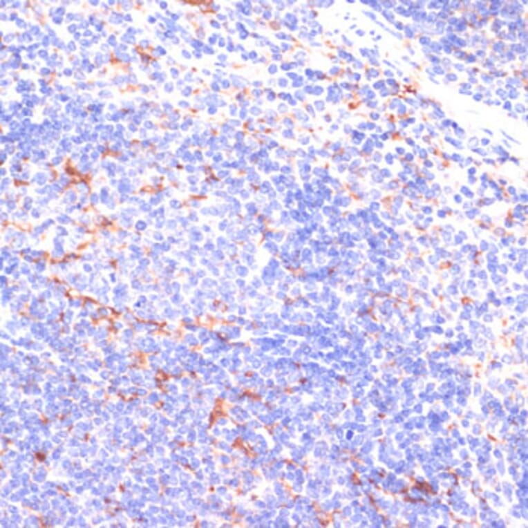 Immunohistochemistry - Anti-IKKi/IKKe Antibody (A12568) - Antibodies.com