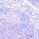 Immunohistochemistry - Anti-IKKi/IKKe Antibody (A12568) - Antibodies.com