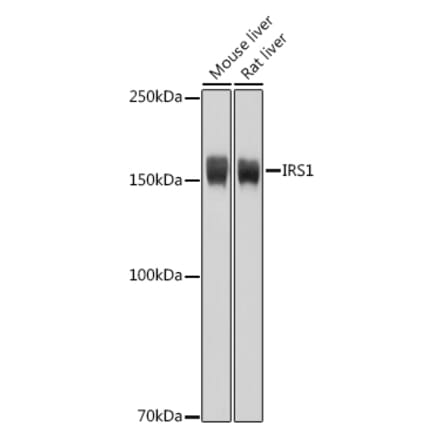 Western Blot - Anti-IRS1 Antibody (A12569) - Antibodies.com