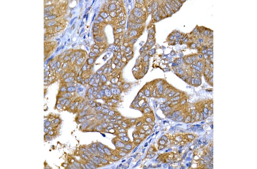 Immunohistochemistry - Anti-IRS1 Antibody (A12569) - Antibodies.com