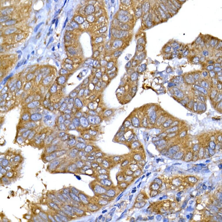 Immunohistochemistry - Anti-IRS1 Antibody (A12569) - Antibodies.com