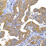 Immunohistochemistry - Anti-IRS1 Antibody (A12569) - Antibodies.com
