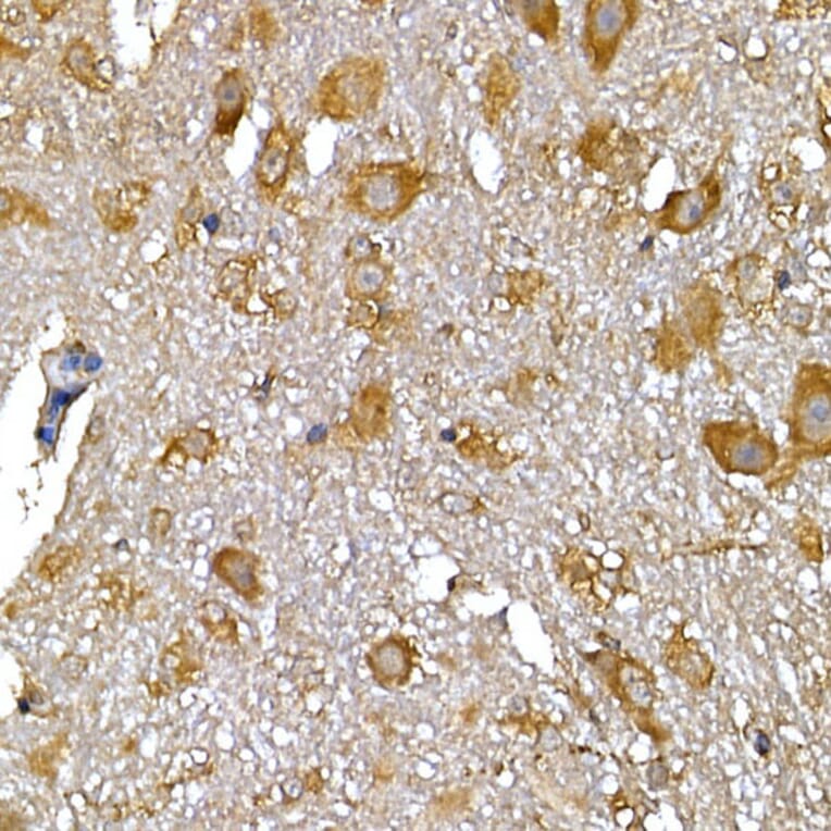 Immunohistochemistry - Anti-IRS1 Antibody (A12569) - Antibodies.com