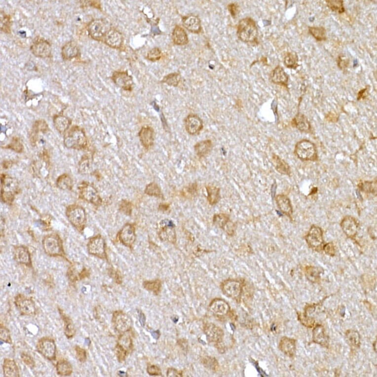 Immunohistochemistry - Anti-IRS1 Antibody (A12569) - Antibodies.com