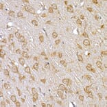 Immunohistochemistry - Anti-IRS1 Antibody (A12569) - Antibodies.com