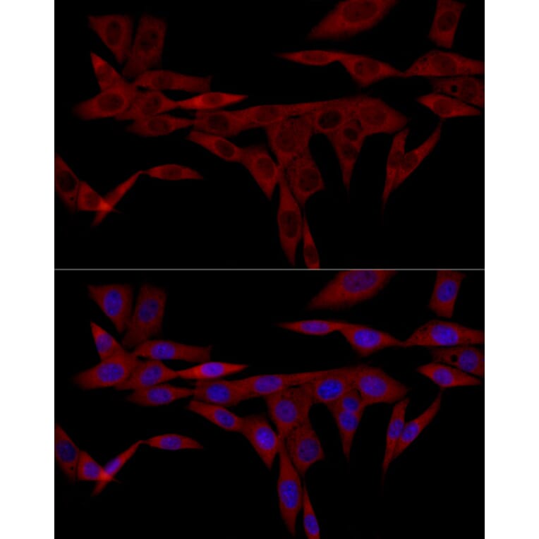 Immunofluorescence - Anti-IRS1 Antibody (A12569) - Antibodies.com