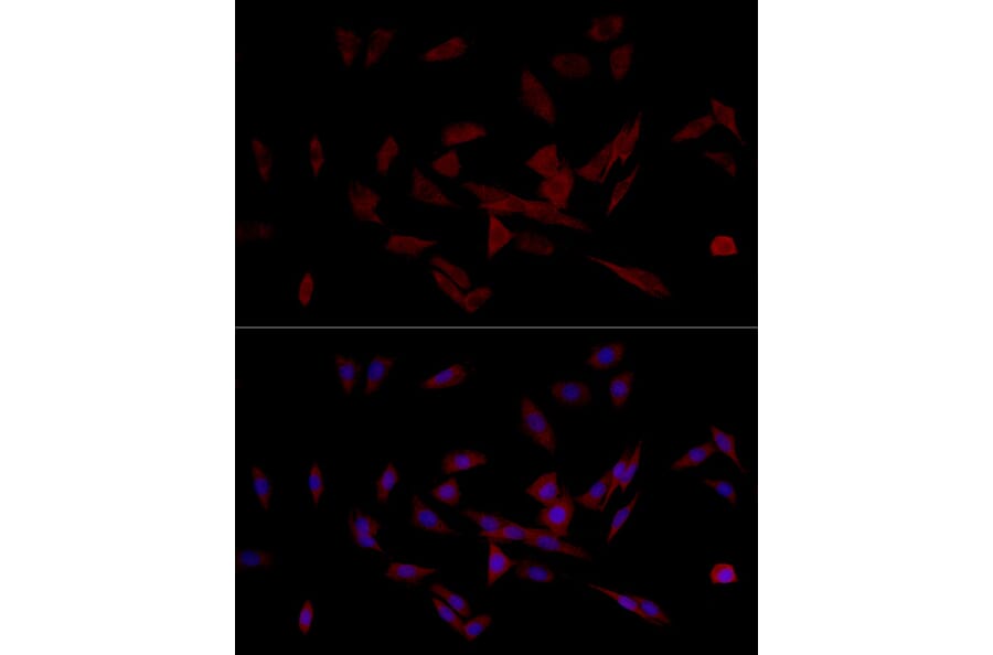 Immunofluorescence - Anti-IRS1 Antibody (A12569) - Antibodies.com