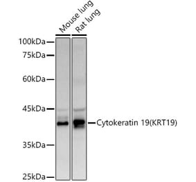Western Blot - Anti-Cytokeratin 19 Antibody (A12571) - Antibodies.com