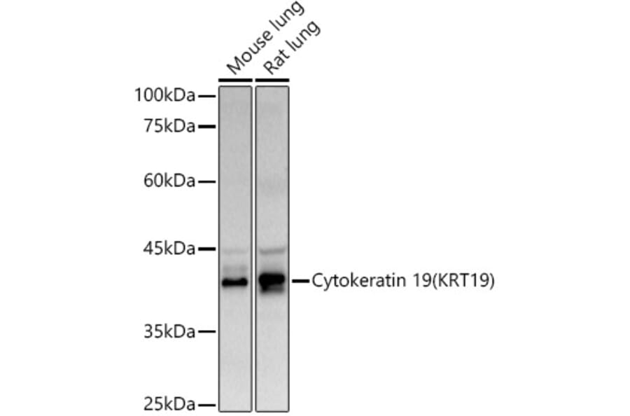 Western Blot - Anti-Cytokeratin 19 Antibody (A12571) - Antibodies.com
