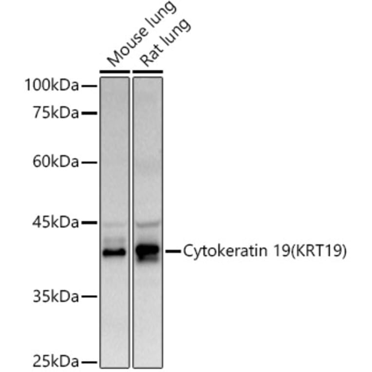 Western Blot - Anti-Cytokeratin 19 Antibody (A12571) - Antibodies.com