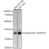 Western Blot - Anti-Cytokeratin 19 Antibody (A12571) - Antibodies.com