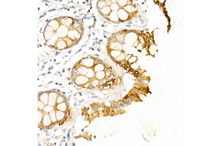 Immunohistochemistry - Anti-Cytokeratin 19 Antibody (A12571) - Antibodies.com