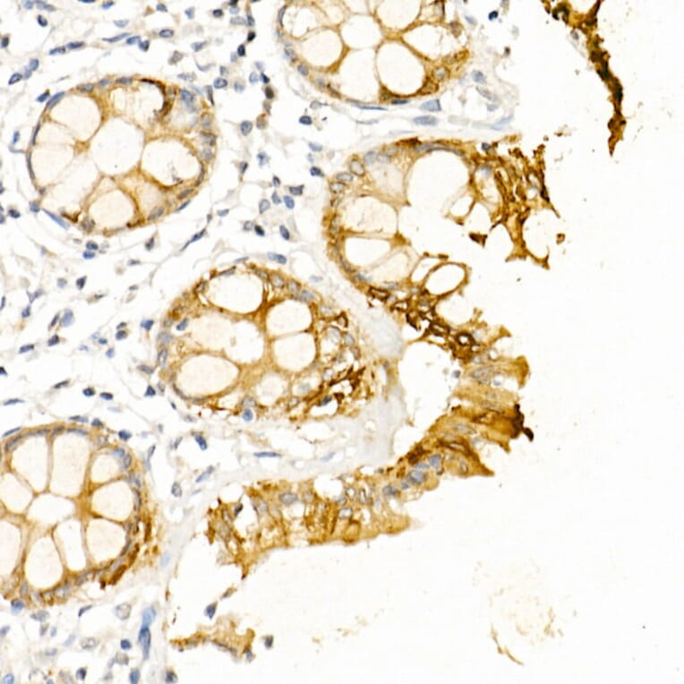Immunohistochemistry - Anti-Cytokeratin 19 Antibody (A12571) - Antibodies.com