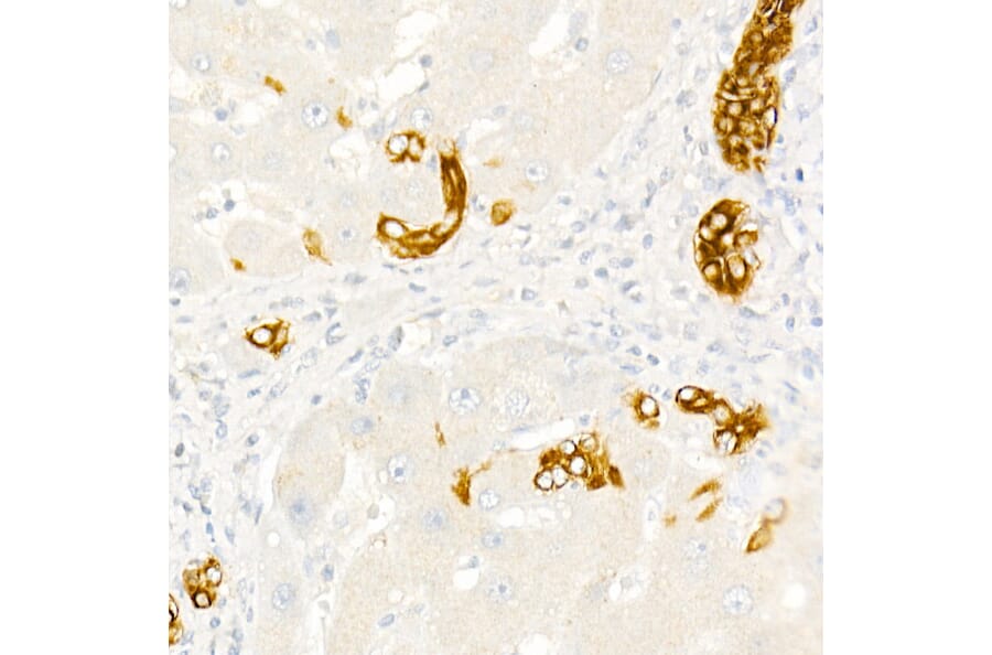 Immunohistochemistry - Anti-Cytokeratin 19 Antibody (A12571) - Antibodies.com