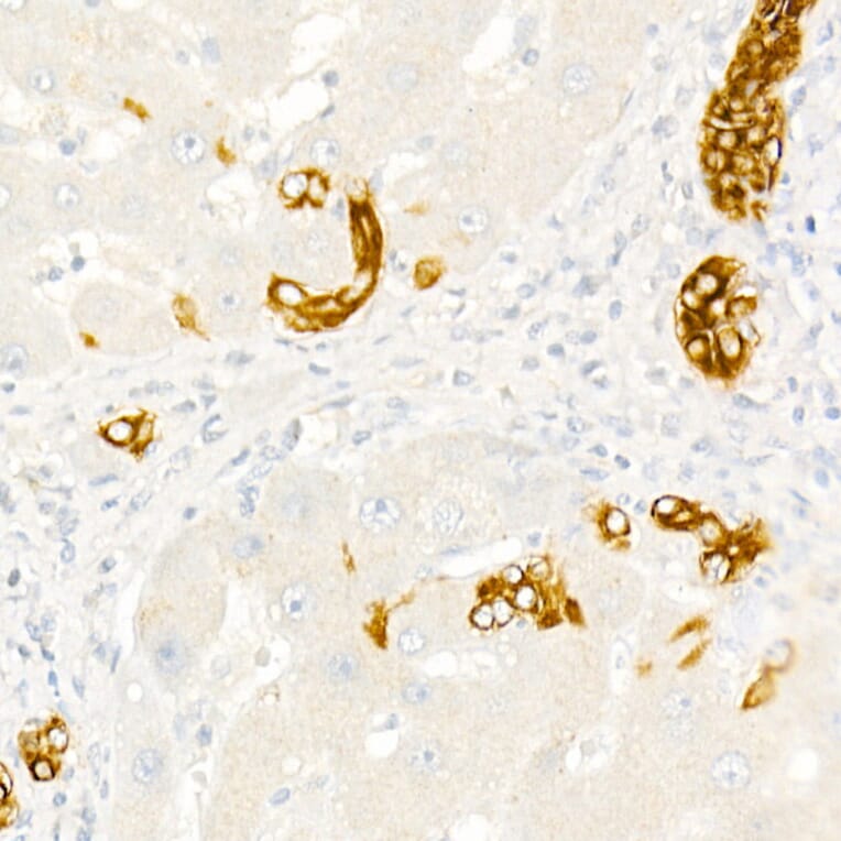 Immunohistochemistry - Anti-Cytokeratin 19 Antibody (A12571) - Antibodies.com