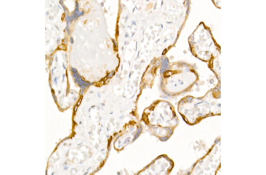 Immunohistochemistry - Anti-Cytokeratin 19 Antibody (A12571) - Antibodies.com