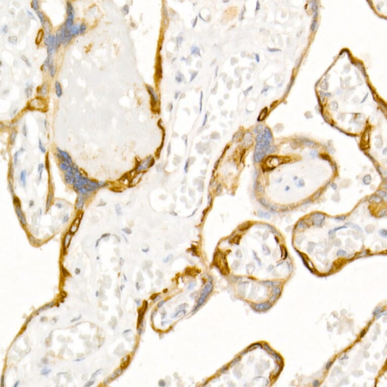 Immunohistochemistry - Anti-Cytokeratin 19 Antibody (A12571) - Antibodies.com
