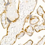 Immunohistochemistry - Anti-Cytokeratin 19 Antibody (A12571) - Antibodies.com