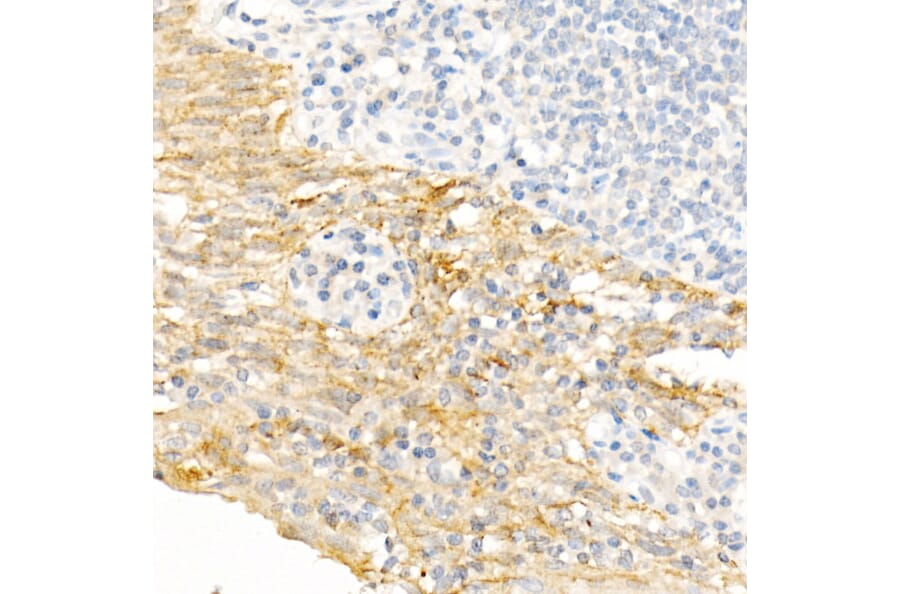 Immunohistochemistry - Anti-Cytokeratin 19 Antibody (A12571) - Antibodies.com