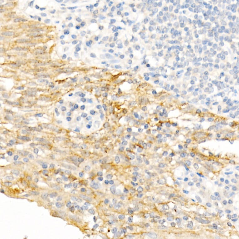 Immunohistochemistry - Anti-Cytokeratin 19 Antibody (A12571) - Antibodies.com