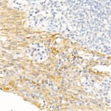 Immunohistochemistry - Anti-Cytokeratin 19 Antibody (A12571) - Antibodies.com