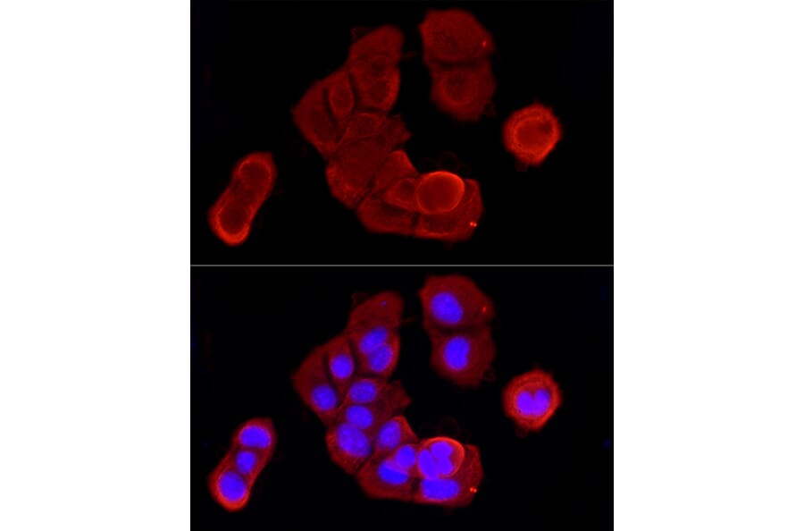 Immunofluorescence - Anti-Cytokeratin 19 Antibody (A12571) - Antibodies.com