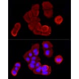 Immunofluorescence - Anti-Cytokeratin 19 Antibody (A12571) - Antibodies.com