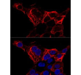 Immunofluorescence - Anti-Cytokeratin 20 Antibody (A12572) - Antibodies.com