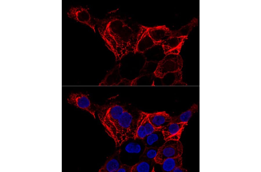 Immunofluorescence - Anti-Cytokeratin 20 Antibody (A12572) - Antibodies.com