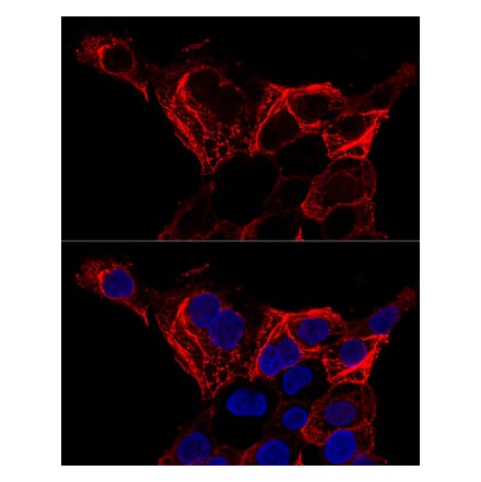 Immunofluorescence - Anti-Cytokeratin 20 Antibody (A12572) - Antibodies.com