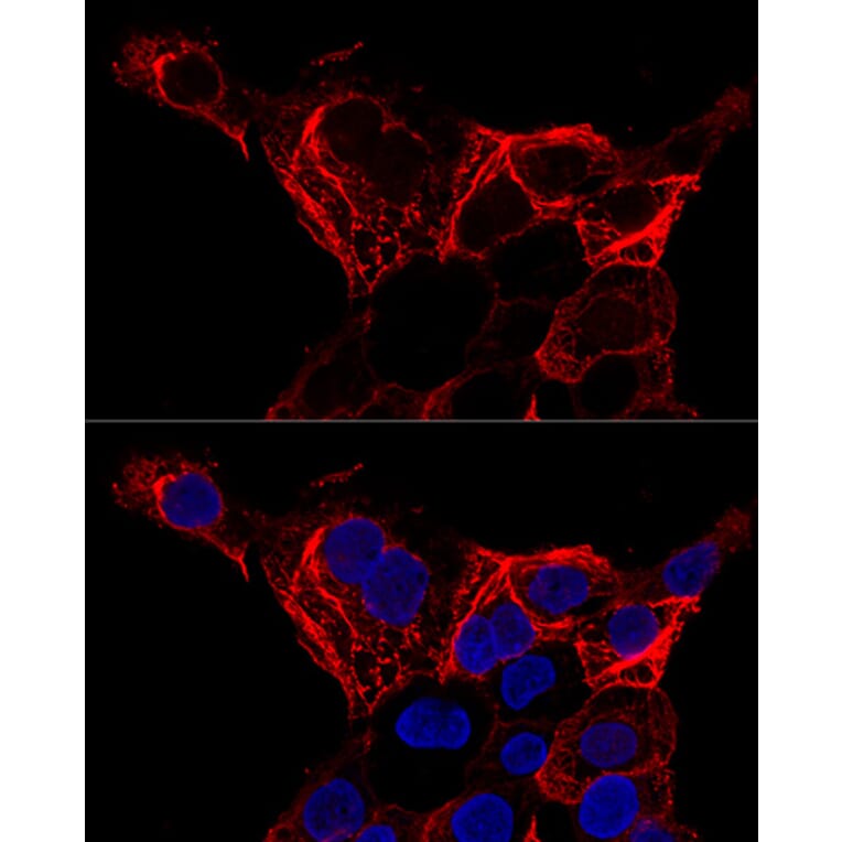 Immunofluorescence - Anti-Cytokeratin 20 Antibody (A12572) - Antibodies.com