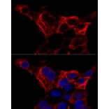 Immunofluorescence - Anti-Cytokeratin 20 Antibody (A12572) - Antibodies.com