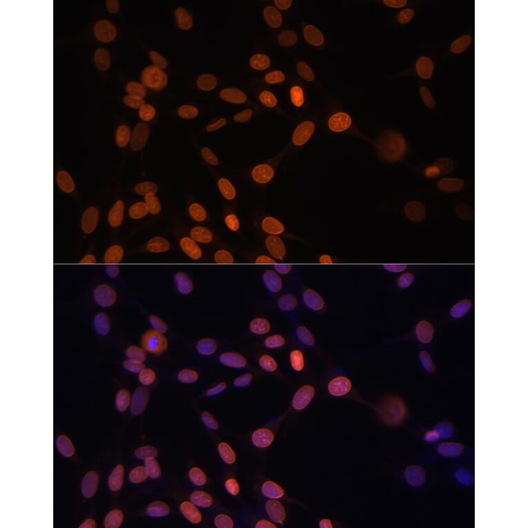 Immunofluorescence - Anti-Lamin A Antibody (A12573) - Antibodies.com