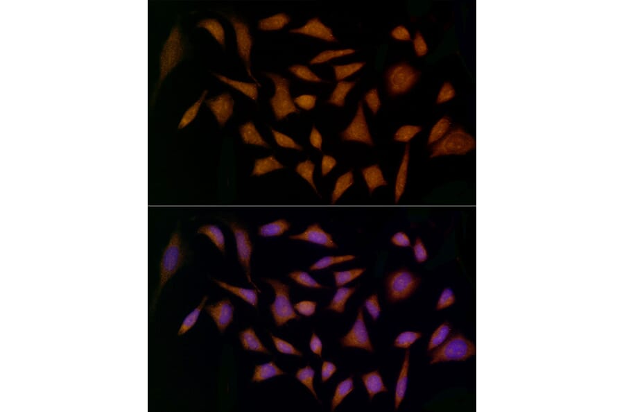 Immunofluorescence - Anti-Midkine Antibody (A12574) - Antibodies.com