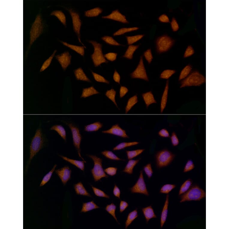 Immunofluorescence - Anti-Midkine Antibody (A12574) - Antibodies.com