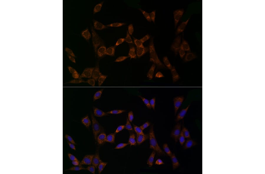 Immunofluorescence - Anti-Midkine Antibody (A12574) - Antibodies.com