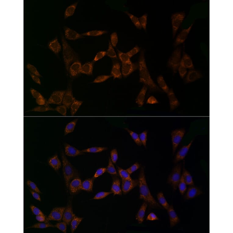 Immunofluorescence - Anti-Midkine Antibody (A12574) - Antibodies.com