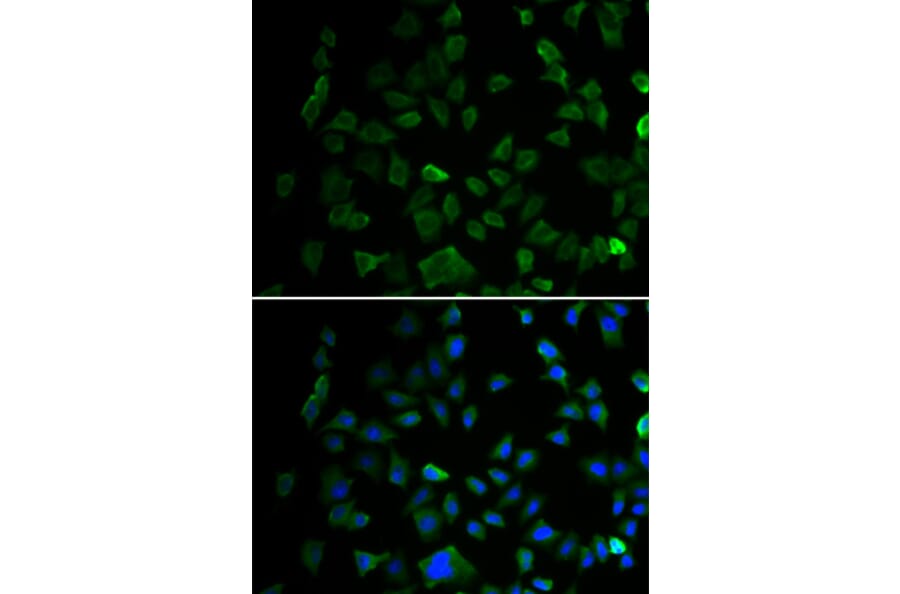 Immunofluorescence - Anti-MEK1 Antibody (A12575) - Antibodies.com