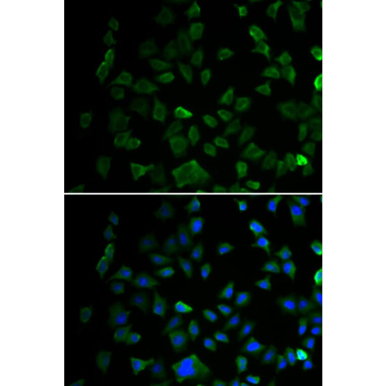 Immunofluorescence - Anti-MEK1 Antibody (A12575) - Antibodies.com