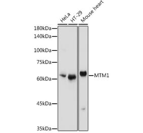 Western Blot - Anti-MTM1 Antibody (A12578) - Antibodies.com
