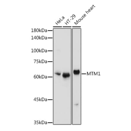Western Blot - Anti-MTM1 Antibody (A12578) - Antibodies.com