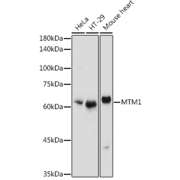 Western Blot - Anti-MTM1 Antibody (A12578) - Antibodies.com